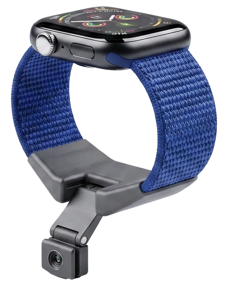 Tap Watch Band — blue cordura band with gesture-sensing housing, fitted to an Apple Watch.